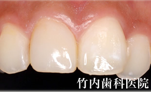 治療例01術後