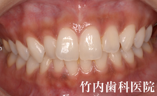 治療例02術後