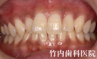 治療例02術前