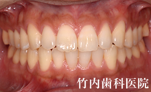 治療例03術後